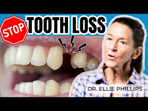 Prevent Tooth Loss as You Age