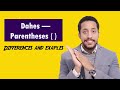 Dashes and Parentheses Usage