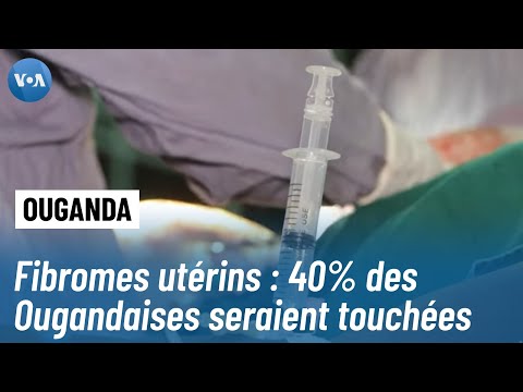 Ouganda : Les femmes continuent de souffrir de fibromes utérins