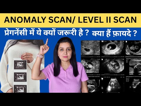 प्रेगनेंसी में Anomaly scan/ Level II Scan कब और क्यों कराएँ
