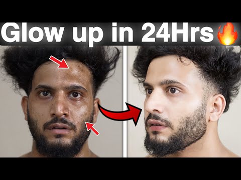 Transform Your Look In Just 24 Hours! Glow Up Tips For Guys In Hindi| Ultimate Guide To Glowing Up