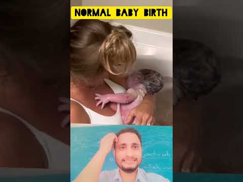 Normal delivery📮 #babyborn #newbornbaby #trending @MRAnsari7987 @nursestechnology1199