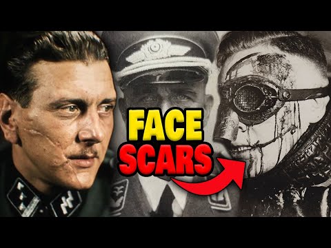 Why Did High-Ranking Nazis Have Face Scars?