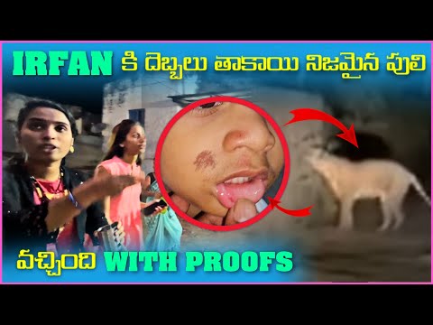 irfan కి దెబ్బలు తాకాయి నిజమైన పులి వచ్చింది | Pareshan Boys1