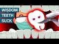 Wisdom Teeth: Risks and Facts