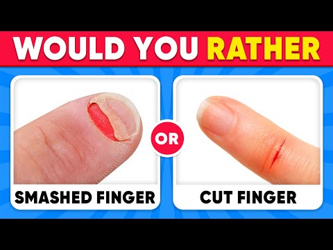 Would You Rather...? EXTREME Edition 😱😨🧠 100 HARDEST Choices Ever!