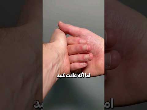 چی میشه اگه قولنج انگشتمون رو بشکنیم 😧