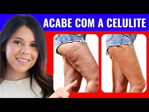 COMO ACABAR COM A CELULITE? ( DE MANEIRA NATURAL E EM CASA)