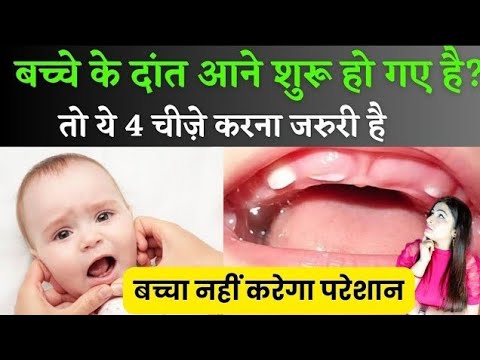 Teething Home Remedies | शिशु के दांत निकलते वक़्त कैसे करें घरेलू उपचार