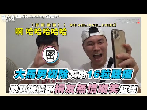 【大馬男切除嘴內16粒腫瘤 臉腫像驢子損友無情嘲笑超壞】｜@阿良XiaoLiang