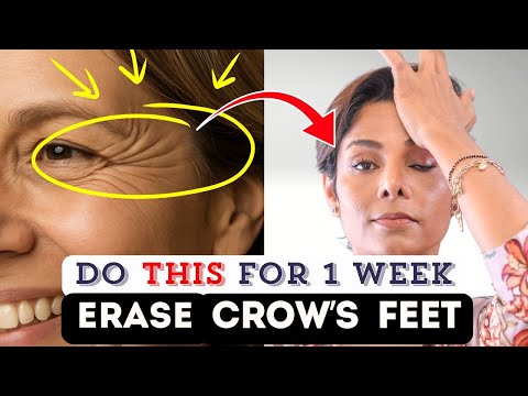 7-Day Face Yoga Challenge: Reduce Crow's Feet Around eyes Naturally Without Botox or Fillers!