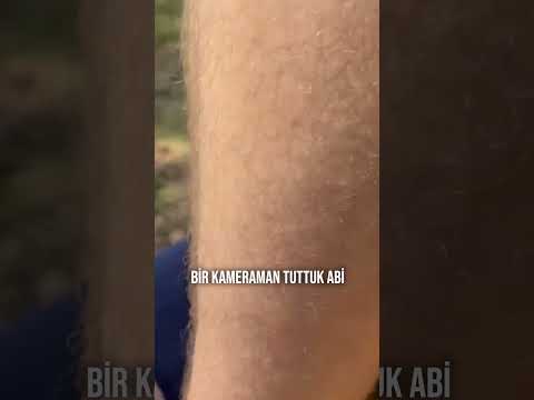 Kameramanıma Kene Girdi..!