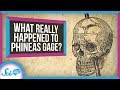 Phineas Gage and Brain Specialization