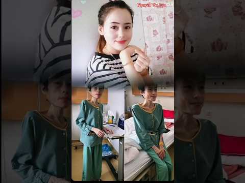 Cô gái gặp biến cố từ 54kg còn 18kg #tintuc #giaitri