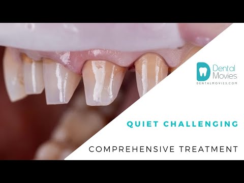 Quiet challenging comprehensive treatment