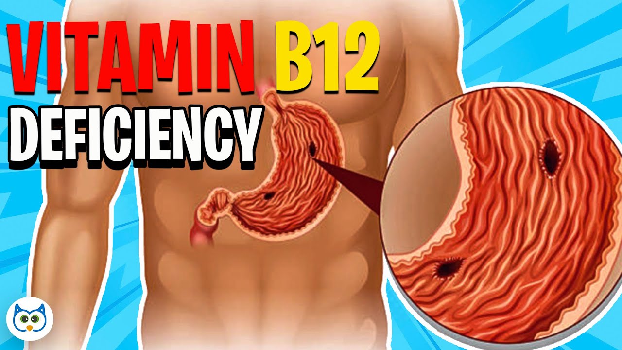Top 7 Causes of Vitamin B12 Deficiency You Need to Know About