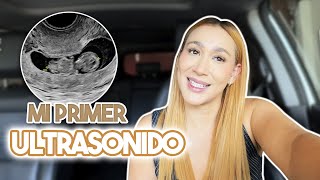 ¡ESCUCHAMOS SU CORAZÓN ♥️  POR PRIMERA VEZ! 🥺 | Mi primer ultrasonido