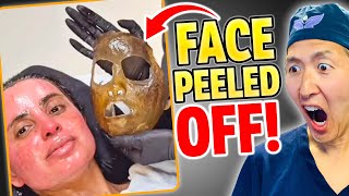 Peeling Off Faces With DANGEROUS Phenol 3! Plastic Surgeon Reacts!