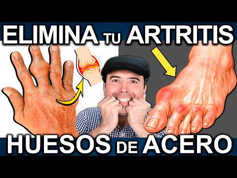 🧬 DESCUBRIMIENTO: Por Qué Tu Artritis NO Se Cura (Y Cómo SOLUCIONARLO)