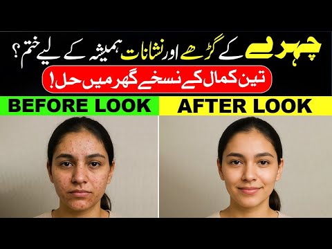Chehre Ke Gadhay Aur Nishan Khatam | Sirf 3 Gharelu Nuskhe