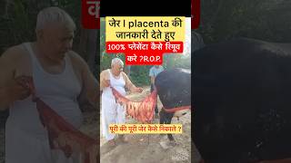 Retention of placenta l dr Umar Khan
