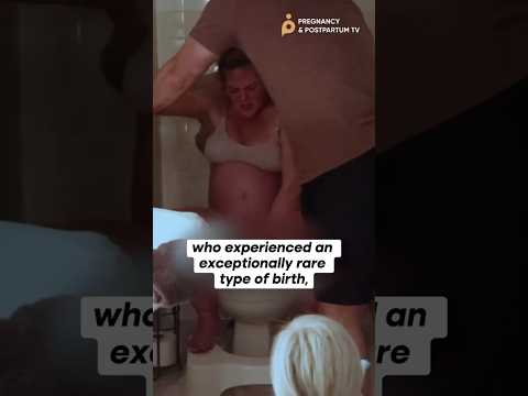 ‼️Did you SEE what they wiped off the baby? #rarebirth