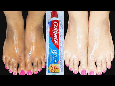 Permanent hand and foot whitening cream | How to Whiten feet Instantly | Colgate for feet whitening