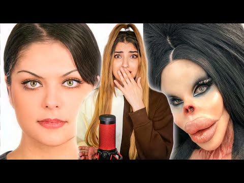 7 عمليات تجميل فاشلة إنتهت بشكل كارثي وصادم !!