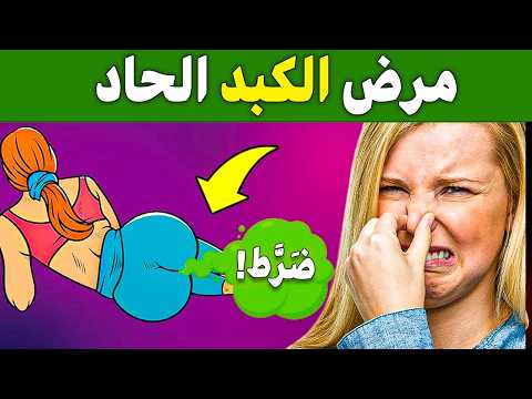 17 علامة صادمة أن كبدك على حافة الانهيار! 🚨 (إذا ظهرت لديك أي منها – اتخذ إجراءً فورًا!)
