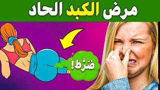 17 علامة صادمة أن كبدك على حافة الانهيار! 🚨 (إذا ظهرت لديك أي منها – اتخذ إجراءً فورًا!)