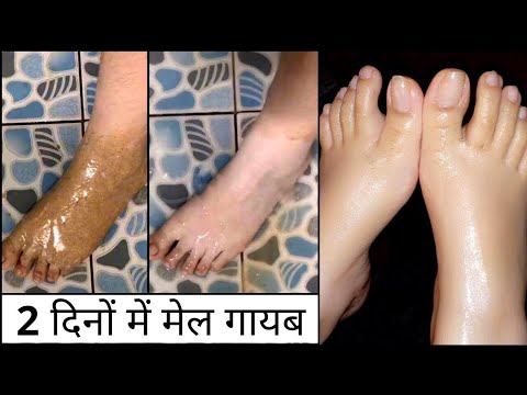 चेहरे व पुरे शरीर की सालों साल जमी काली मैल व गंदगी मिनटों में साफ करें| Remove Dirt In just 1 Time