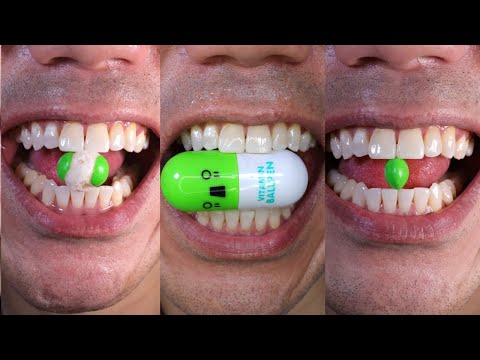 Satisfying Chewing ASMR #Compilation #ASMR #DoctorTristanPeh