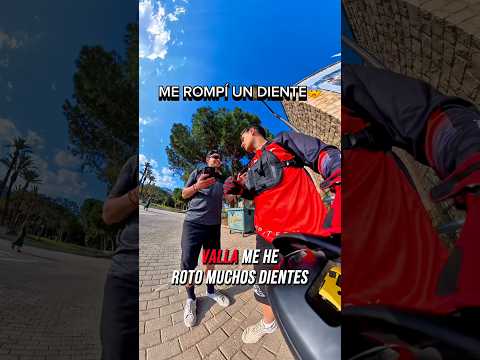 Así es como perdí un diente…😅☹️