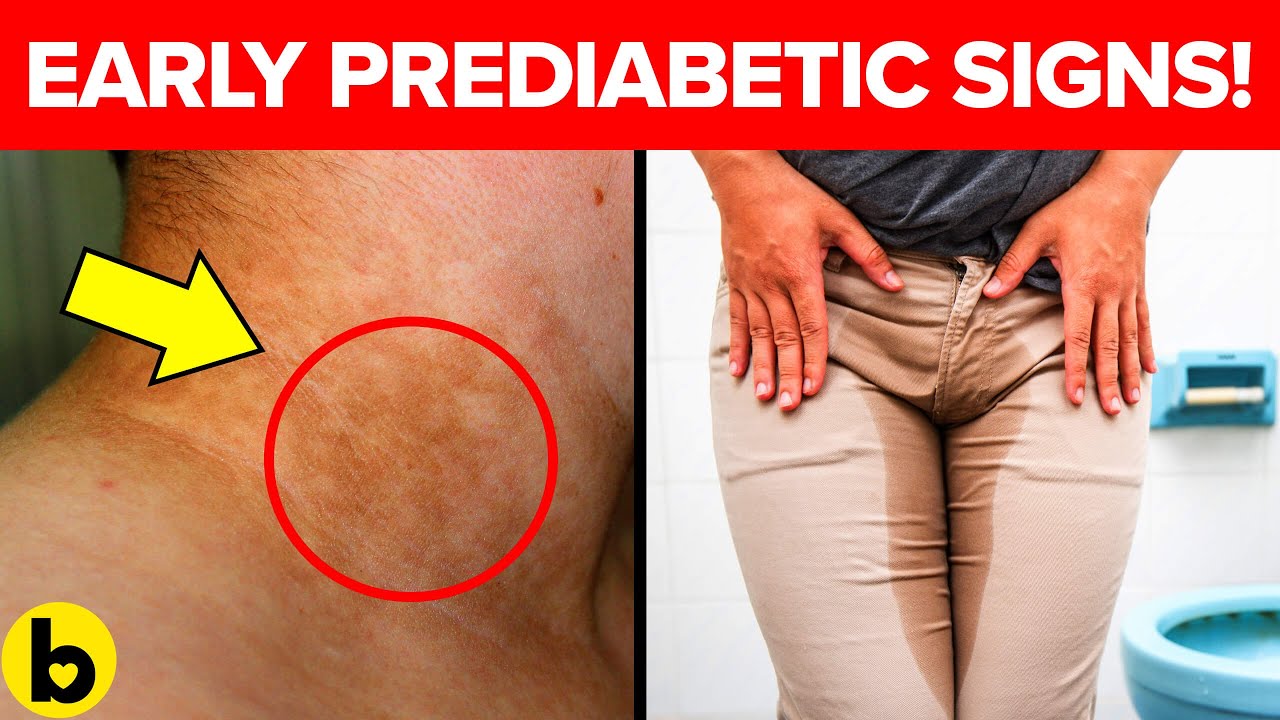 7 Warning Signs that you are Prediabetic