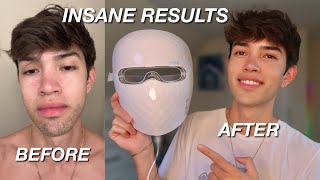I Tried the Viral Red Light Therapy Mask for 30 Days..