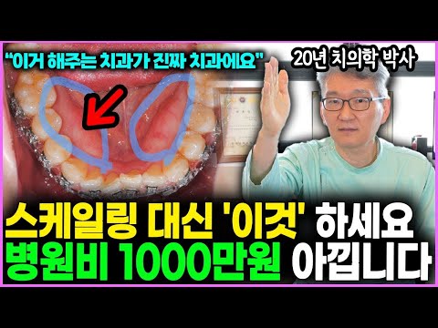 치과에서 '이 것’ 받으세요 나이들어 임플란트 1000만원 아낍니다 스케일링, 잇몸치료 보다 중요합니다 (박한성 원장 1부)