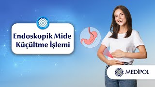 Kesisiz Mide Küçültme: Endoskopik Sleeve Gastroplasti (ESG)