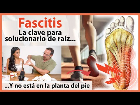 🔴 Fascitis Plantar: No se puede curar con una pelota! 👉 Método Revolucionario Para Aliviar El Dolor!
