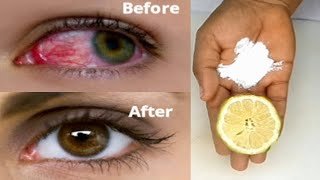 Eat this 2 to improve eyesight, Remove bad eyesight