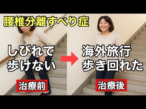【腰椎分離すべり症の鍼灸整体】腰痛と両足のしびれで足に力が入らず、排便もうまくできない状態から奇跡の復活✨過去に胸椎固定術の手術経験あり。西住之江鍼灸整体院