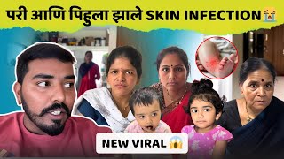 परी आणि पिहुला झाले Skin Infection😭| New Viral 😱| Family Vlog | Komal Om Sawale