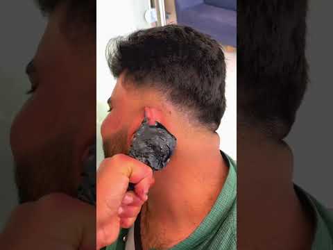 ازاله شعر الاذن بالشمع 😂✂️💈 #foryou #اكسبلور #comedyfilms #funny #comedymovies #fyp #comedy #fun