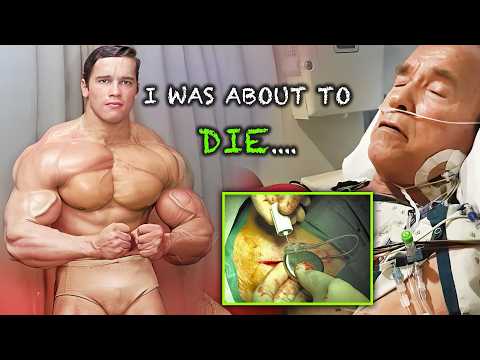 WAS IT STEROID ABUSE? MULTIPLE OPEN HEART SURGERIES - Arnold Schwarzenegger 2024