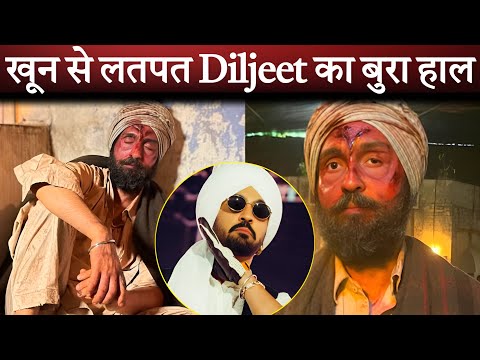 खून से लतपत Diljeet Dosanjh का बुरा हाल || Diljeet Dosanjh का खतरनाक लुक वायरल