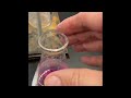 Titration Process and Acid Neutralization
