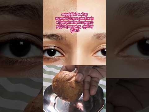 எளிய வீட்டு வைத்தியம் #viralshort #skincare #skincareroutine #beautytips