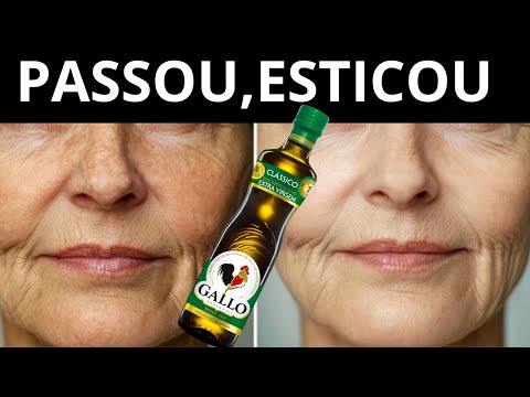 RUGA VELHA e BOCA CAÍDA NUNCA MAIS! PASSA na RUGA e DORME!