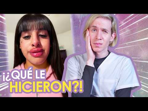 Se RELLENÓ los LABIOS con UNA LASHISTA (ES ILEGAL 🚨) - El DRAMA de LA COQUETA - Simon Scarano