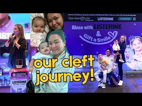 SHARING OUR CLEFT STORY!! ITO NA YATA ANG HIGHLIGHT NG VLOGGING JOURNEY NAMIN AS A FAMILY!