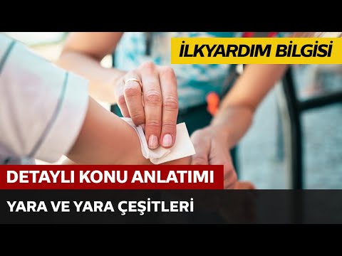 Yara ve Yara Çeşitleri